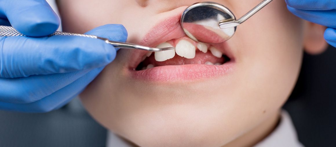 Ortodontski pregled – osnova za postavitev pravilne diagnoze in optimalnega načrta zdravljenja