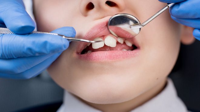 Ortodontski pregled – osnova za postavitev pravilne diagnoze in optimalnega načrta zdravljenja